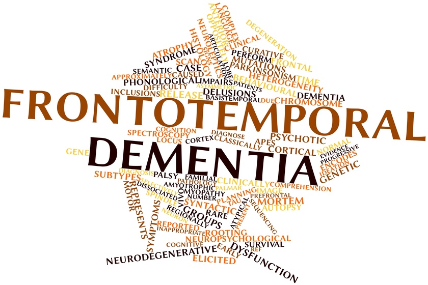What Is Frontotemporal Dementia (FTD)? Rittenhouse Village What Is Frontotemporal Dementia (FTD)? Rittenhouse Village